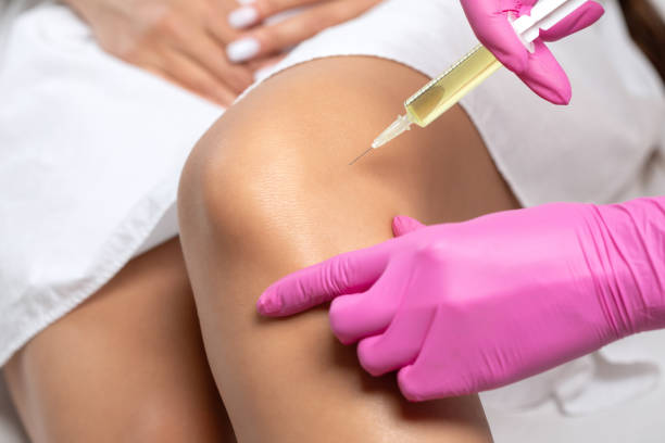 PRP Injections